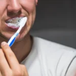 dents blanches
