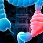 aliments pour nettoyer le colon