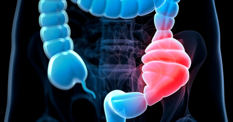 aliments pour nettoyer le colon