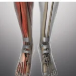 Renforcer les Ligaments et Tendons
