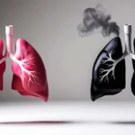 Remèdes Naturels pour Renforcer les Poumons